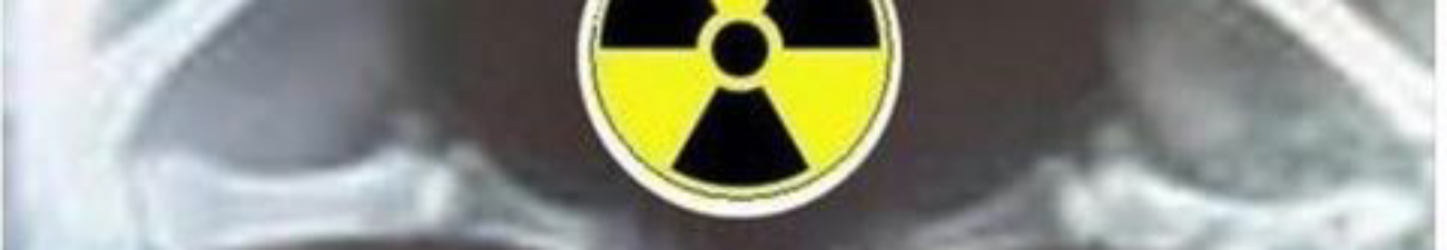 Alyson Araujo Dos Santos